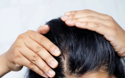 Crescita dei Capelli: Lozione Anticaduta e Rinfoltimento Capelli